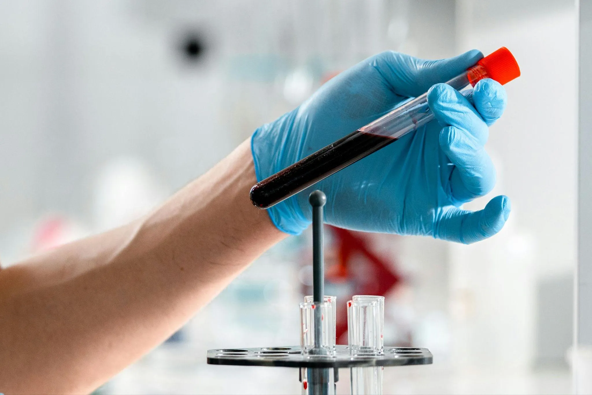 How to Interpret Heavy Metal Blood Test Results