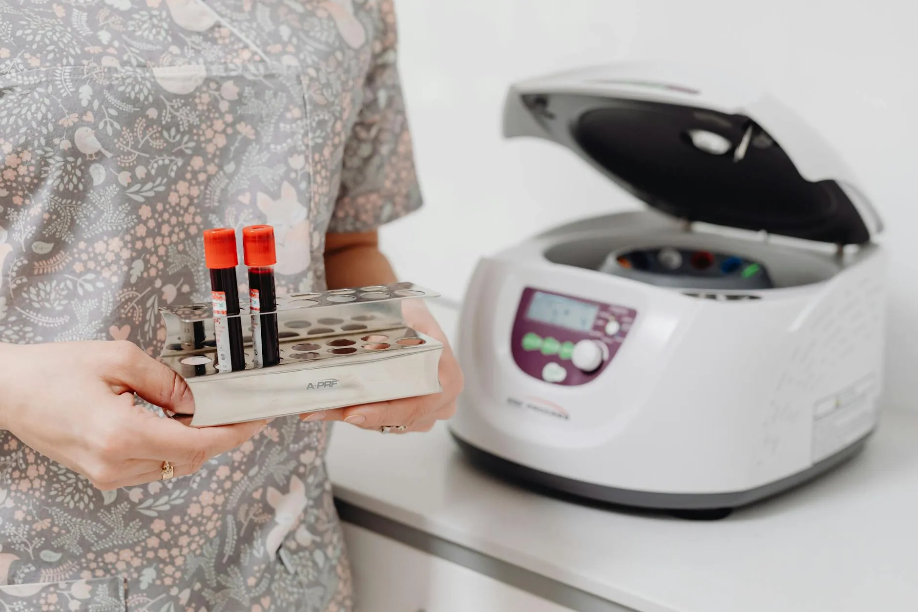 Understanding Autoimmune Markers: Testing, Interpretation, and Evidence-Based Management
