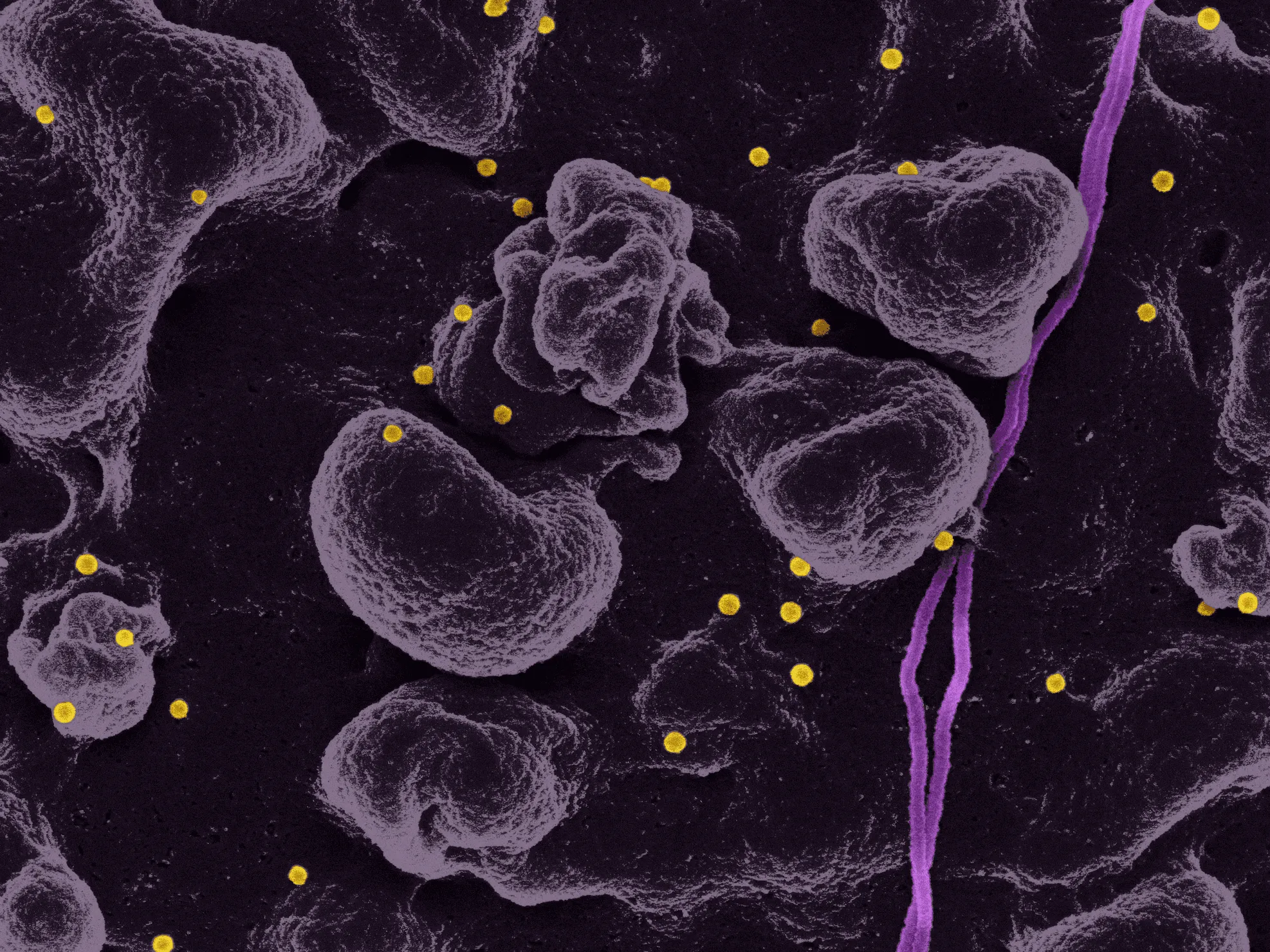 Amylase blood test biomarker