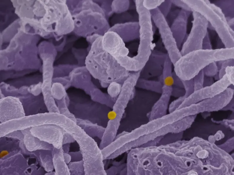 Lyme Disease Screen