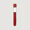 1 Comprehensive lab test with over 100+ biomarkers